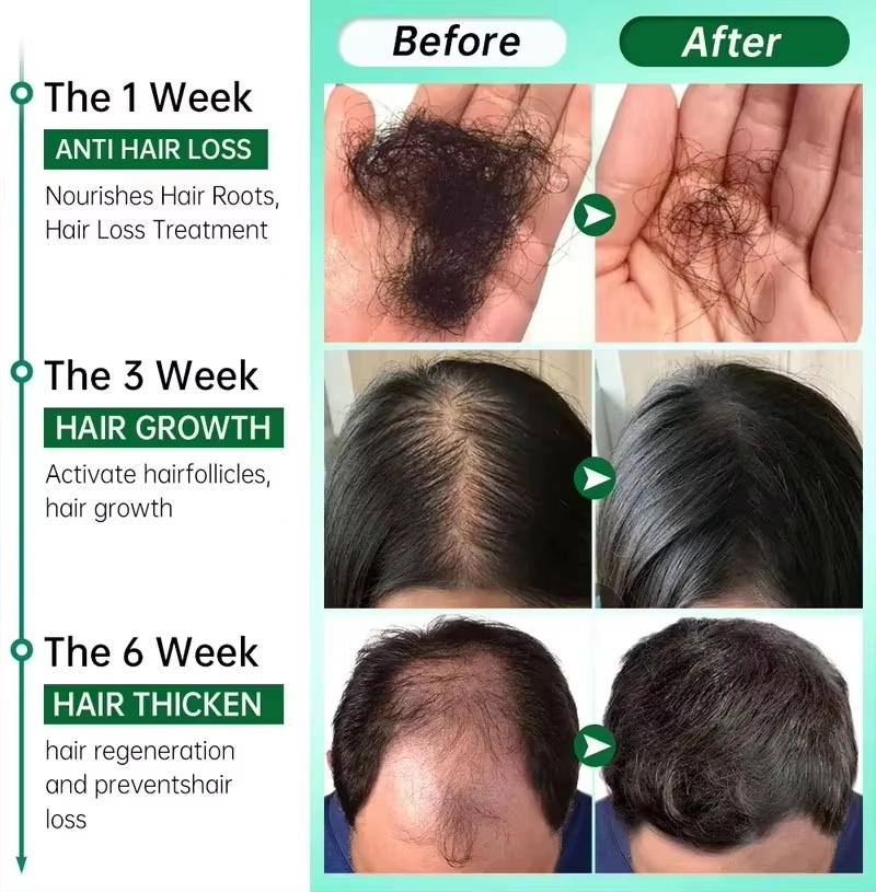 Serum na porost włosów 7-dniow – Hair Care Capsule recenzja i cena