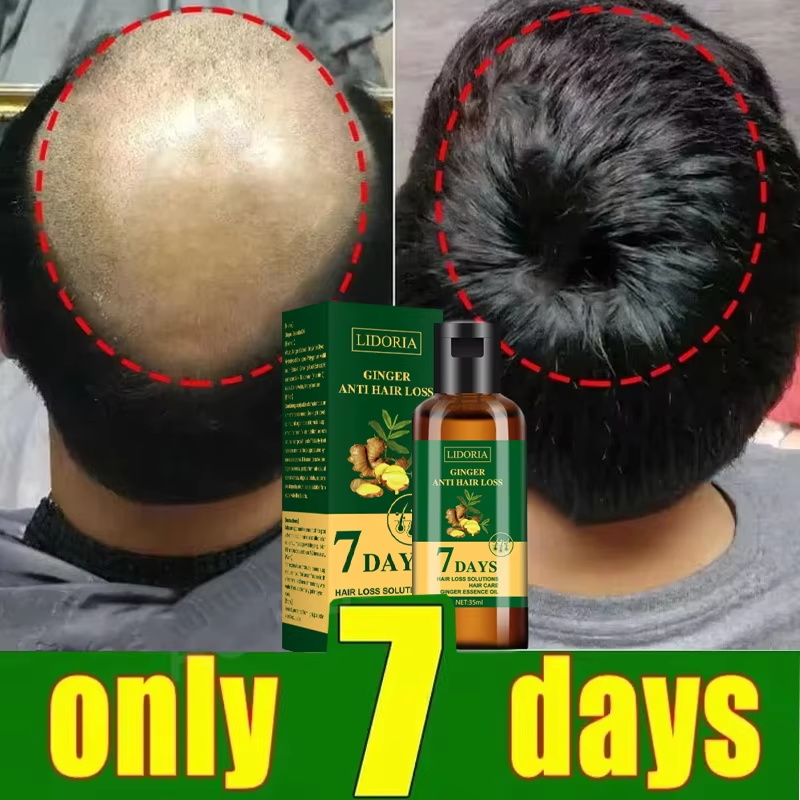 Serum na porost włosów 7-dniow – Hair Care Capsule recenzja i cena